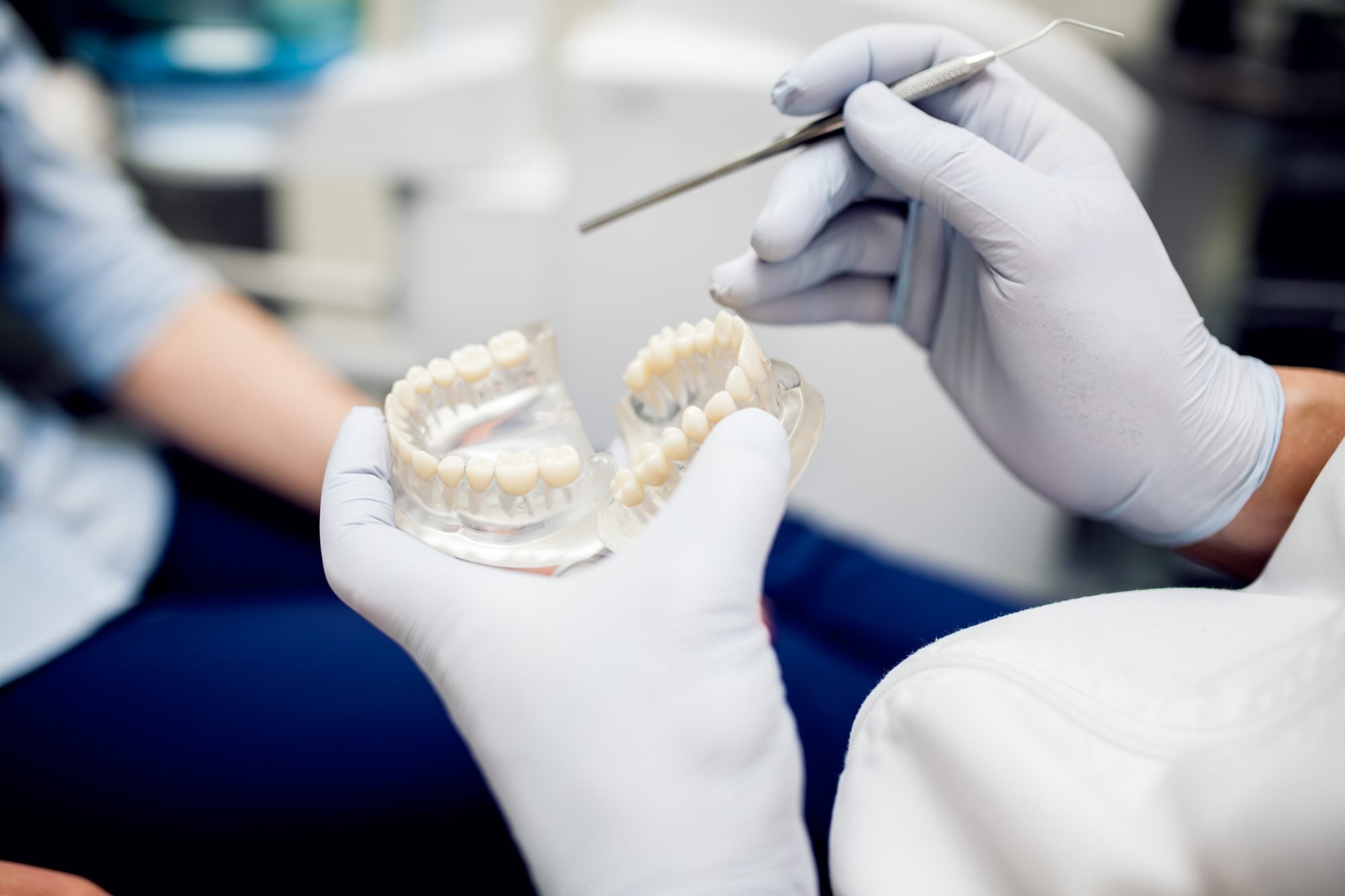 Надійність матеріалів і кваліфікація стоматолога – гарантія довговічності протезування